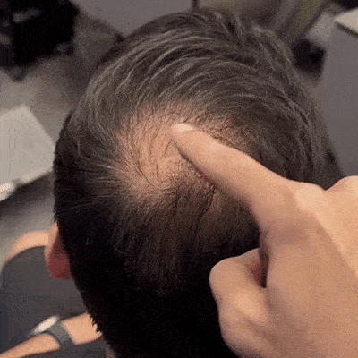 BaldCover 3.0